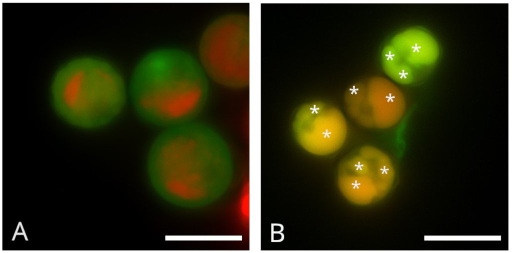 Липиды микроводорослей потенциально улучшат усвоение жиров в молочных смесях