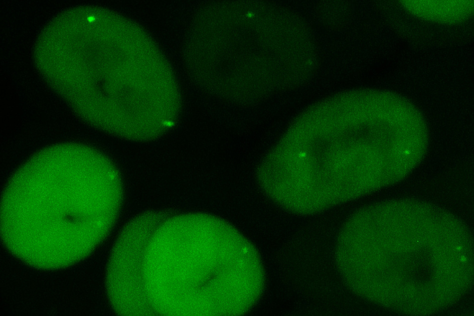 Биологи определили самый эффективный способ визуализации хроматина в клетках