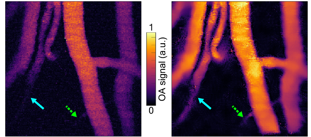 Рис. 2. Изображения сосудов в головном мозге мыши, полученные с помощью только оптической системы лазерного сканирующего микроскопа (слева), сочетанием оптической системы и ультразвукового датчика (справа)