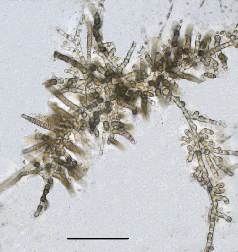 Laminariocolax aecidioides