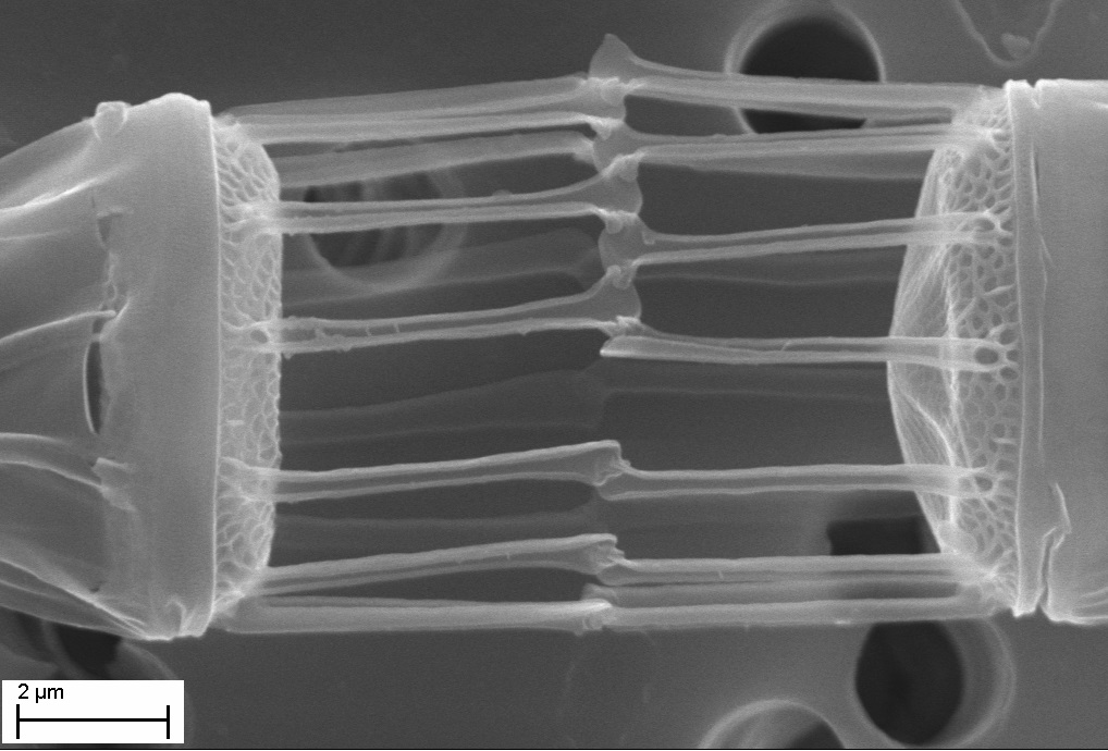 Объект питания, микроводоросль Skeletonema dorhnii. Фотография сделана с помощью сканирующего электронного микроскопа Анной Пономарёвой