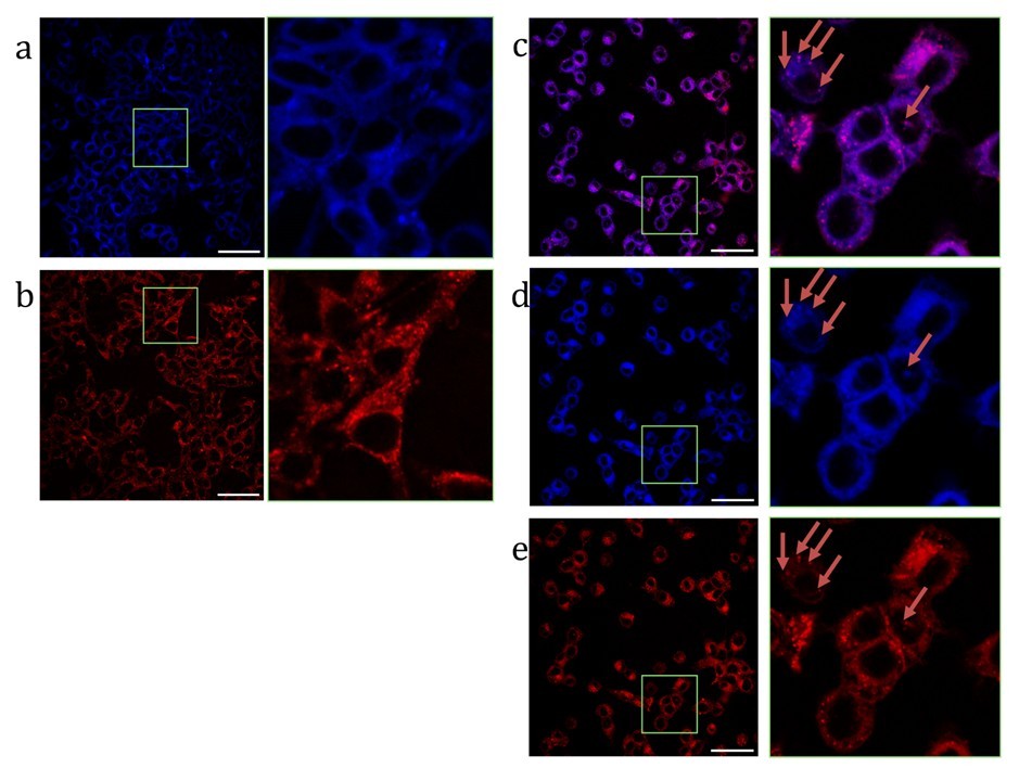 Конфокальная визуализация клеток рака толстой кишки после инкубации в течение двух часов с системами: (а) наночастицы с фотосенсибилизатором; (б) наночастицы с флуорофором; (в) наночастицы с фотосенсибилизатором и флуорофором (совмещенное изображение); (г) наночастицы с фотосенсибилизатором и флуорофором (длина волны возбуждения = 405 нм); (д) наночастицы с фотосенсибилизатором и флуорофором (длина волны возбуждения = 642 нм); (масштабный отрезок 50 мкм)