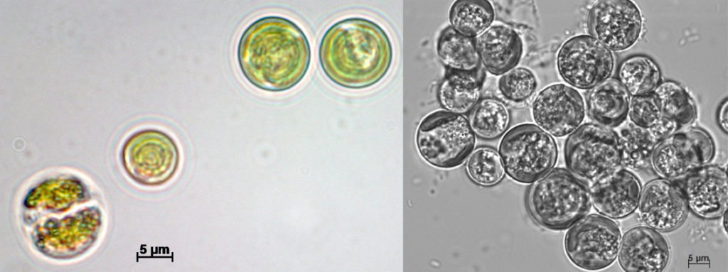Световая микрофотография водоросли Vischeria punctata