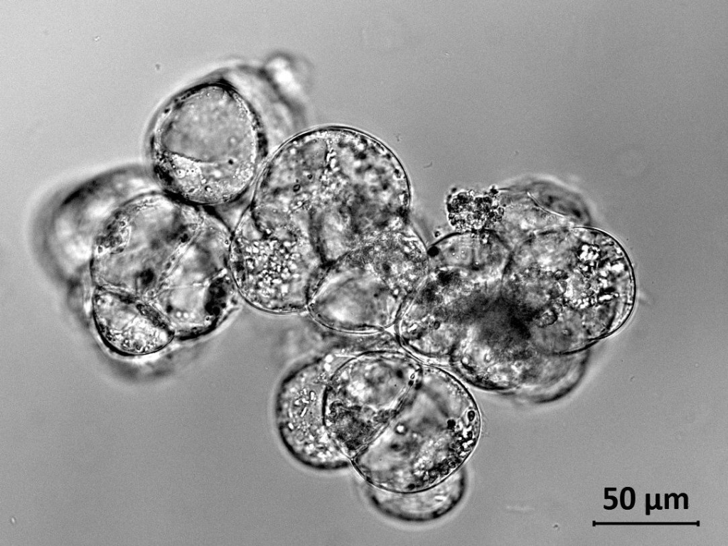 Клетки суспензионной культуры женьшеня японского под микроскопом. Источник: ИФР РАН.
