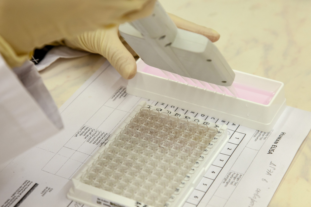  Изучены адаптационные реакции женщин и мужчин, живущих на Европейском Севере России