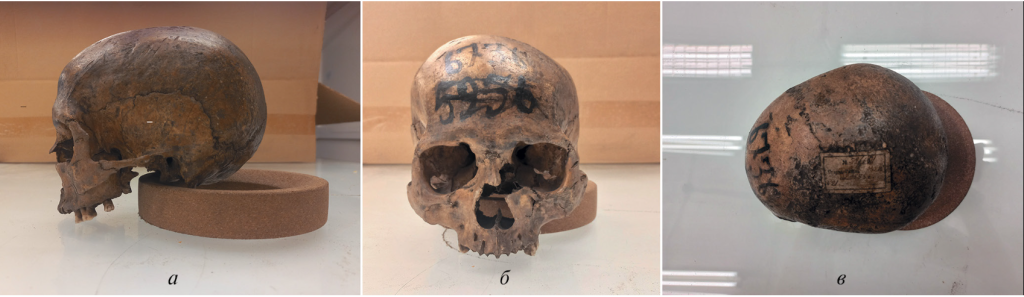 Череп женщины (№ 6736) из краниологической коллекции А.В. Селиванова (раскопки Старой Рязани, 1888 г.). а — вид сбоку, б — вид спереди, в — вид сверху