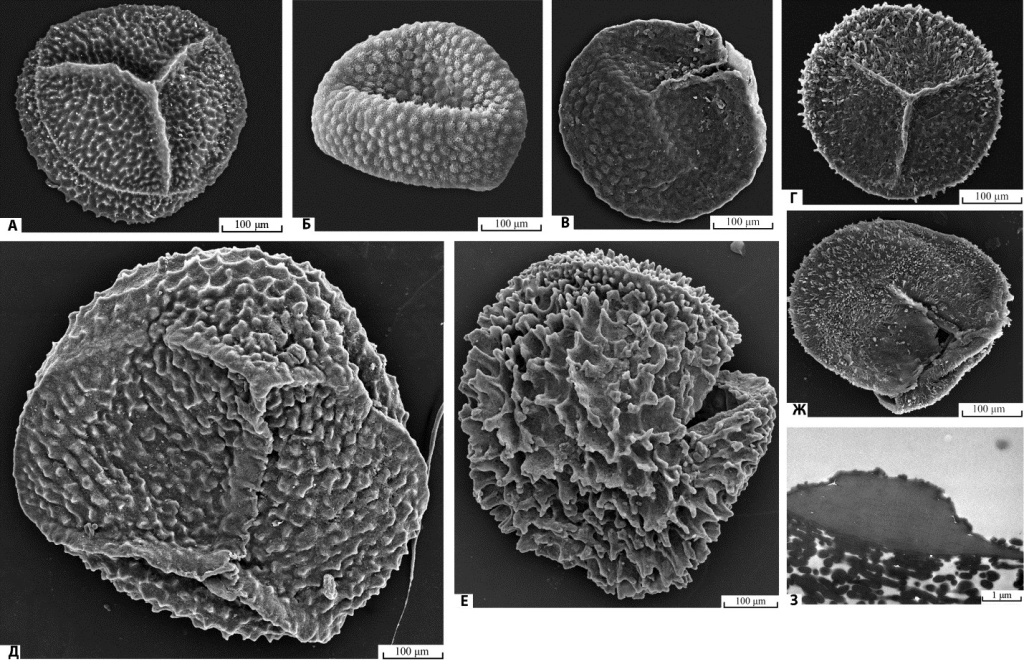 Мегаспоры рода Otynisporites: А, З — O. tuberculatus, Б — O. eotriassicus (группа 1), В — O. eotriassicus (группа 2), Г — O. eotriassicus (группа 3), Д — Otynisporites? sp., Е — O.? tarimensis, Ж — O. maculosus; А—Ж — сканирующая электронная микроскопия, З — трансмиссионная электронная микроскопия; A—Г, Ж, З — пограничные отложения перми и триаса, Д, Е — средний триас