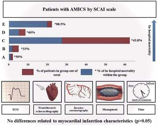 Распределение пациентов с инфарктом миокарда, осложнившимся развитием кардиогенного шока, согласно степени тяжести его течения по шкале SCA