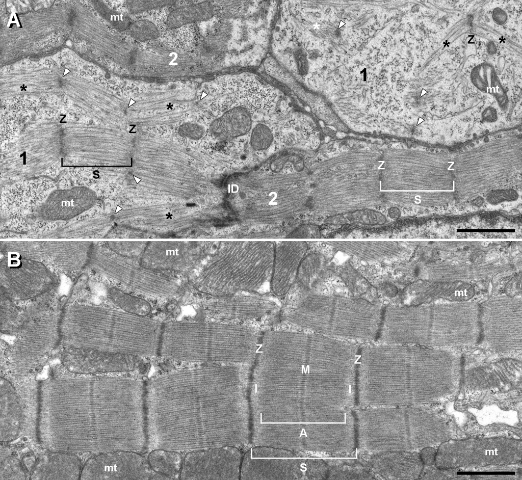 Предложен новый маркер для изучения структуры сердечной мышцы в норме и при патологии