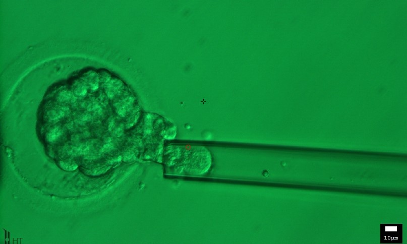 Биопсия эмбриона