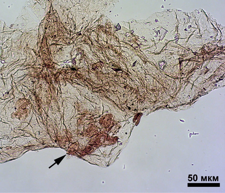 Пыльцевые зерна (стрелка), найденные на кутикуле семязачатка Karkenia, среднеюрские отложения Иркутского угольного бассейна.