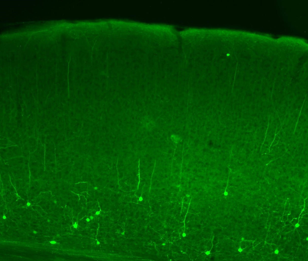 Срез зрительной коры мыши с нейронами, вырабатывающими светочувствительный белок канальный родопсин и зеленый флуоресцентный белок. Источник: Malyshev et al. / BBRC, 2023.