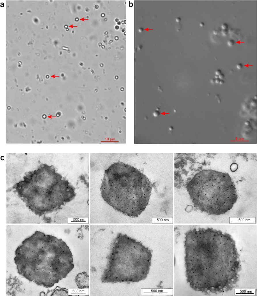 Изображения вирусных частиц, полученные методом световой (сверху) и просвечивающей электронной (снизу) микроскопии. Источник: Martemyanov et al. / Microbiology Spectrum, 2023.