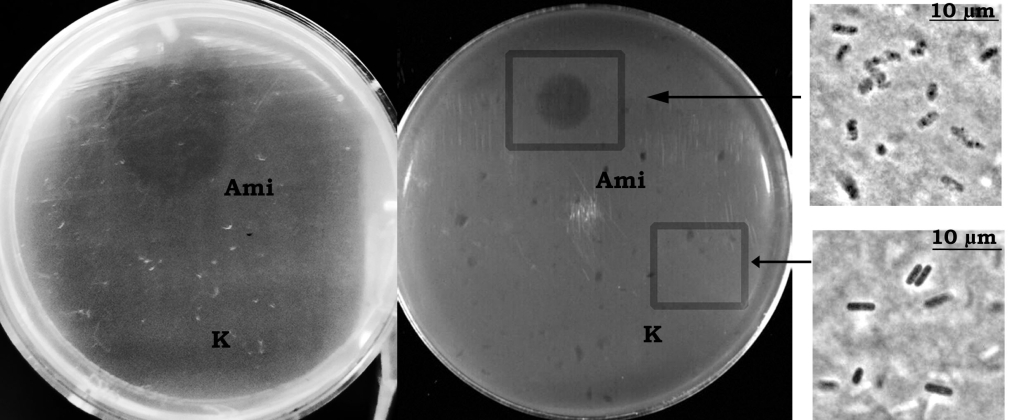 Чашки Петри с вплавленными в агар живыми клетками Bacillus, среди которых возбудитель сибирской язвы (крайняя левая панель). В месте нанесения фермента Ami видна зона просветления, что указывает на гибель бактериальных клеток. Справа результаты фазово-контрастной микроскопии: клетки после обработки ферментом (сверху) и не обработанные ферментом бациллы (снизу)