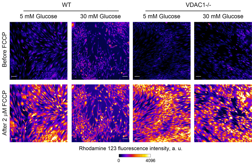 Изменение мембранного потенциала митохондрий в фибробластах кожи человека с нормальной (WT) и пониженной (VDAC1-/-) экспрессией VDAC1 в условиях нормо- и гипергликемии до и после добавки молекулы-разобщителя 