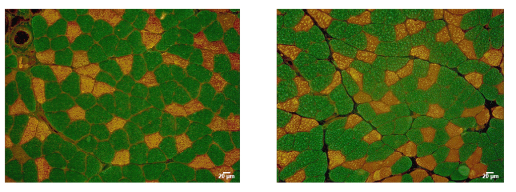 Фотографии поперечных срезов мышц под микроскопом: слева — фото мышцы крысы с нормальной активностью, справа — фото мышцы, обездвиженной на 7 дней. Зеленые — волокна, устойчивые к утомлению; светлые — не устойчивые к утомлению. Источник: Кристина Шарло