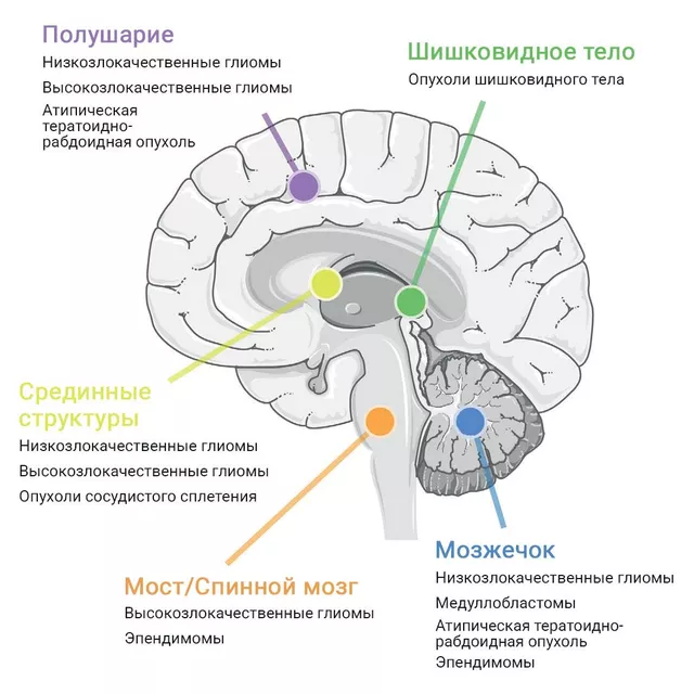 CC BY 4.0 / 2021 Borgenvik, Čančer, Hutter and Swartling / Местоположение злокачественных опухолей мозга