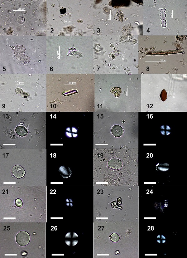 Примеры микроостатков, обнаруженных в зубном камне