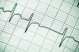 С помощью данных ЭКГ можно предсказать вероятность смертельного исхода для пациентов с заболеваниями сердца